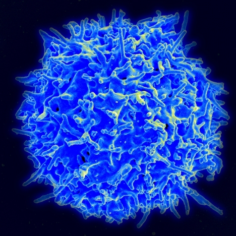 Personer som testats negativt för antikroppar kan ändå ha så kallad T-cellsimmunitet mot Covid-19, visar en ny rapport från Karolinska Institutet.